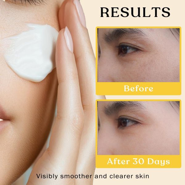 Beef Tallow and Honey Balm for Skin - Moisturizer Cream - 100% Grass Fed Whipped Beef Tallow - Herb Infused - Supports Eczema, Rosacea - Made in USA - Unscented - 2 oz - Image 5